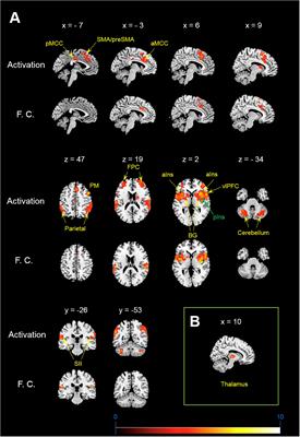 The Functional Network Processing Acute Electrical Itch Stimuli in Humans